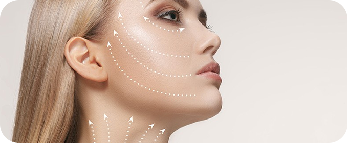 Fios de Sustentação