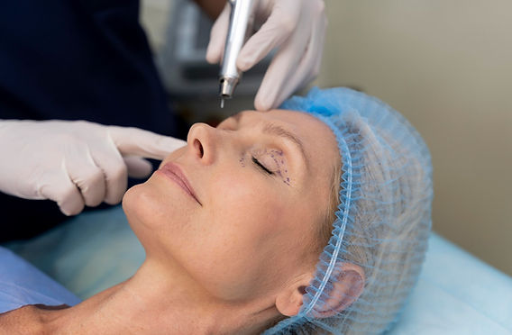 Laser CO2 (Pálpebra)