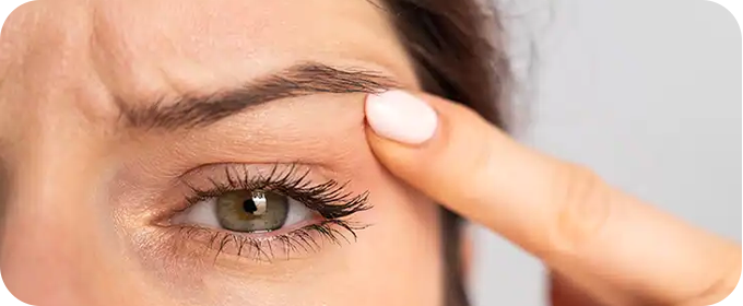 Suspensão de Supercílios