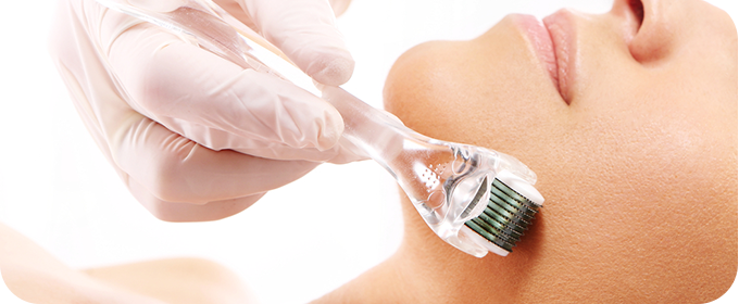 Micro e Peelings imagem complementar